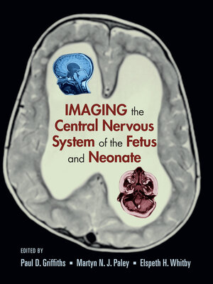 cover image of Imaging the Central Nervous System of the Fetus and Neonate